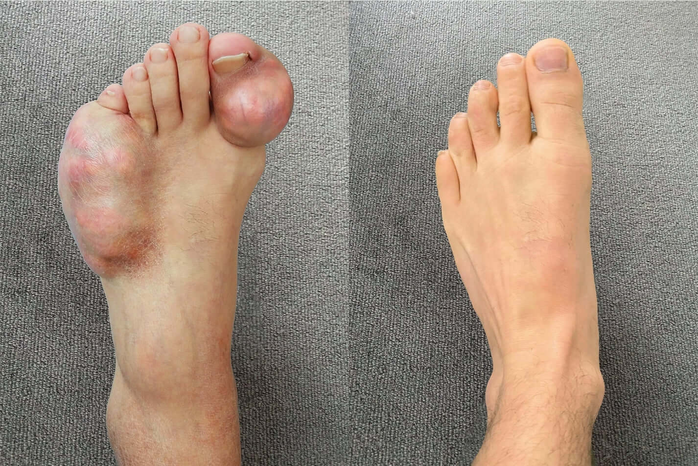 Relieflogix Bee Venom Bone Care Cream